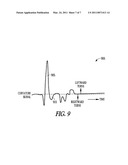 MORPHOLOGY BASED ISCHEMIA DETECTION USING INTRACARDIAC ELECTROGRAMS diagram and image