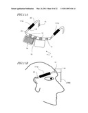 ELECTROENCEPHALOGRAM INTERFACE SYSTEM diagram and image