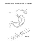 BIOPSY DEVICE diagram and image