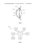 Glaucoma Drainage Device with Pump diagram and image