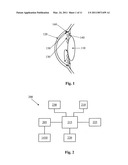 Power Saving Glaucoma Drainage Device diagram and image