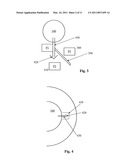 Power Saving Glaucoma Drainage Device diagram and image