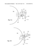 Power Saving Glaucoma Drainage Device diagram and image