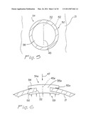 SURGICAL ACCESS APPARATUS AND METHOD diagram and image