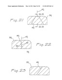 SURGICAL ACCESS APPARATUS AND METHOD diagram and image