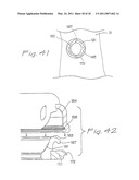SURGICAL ACCESS APPARATUS AND METHOD diagram and image