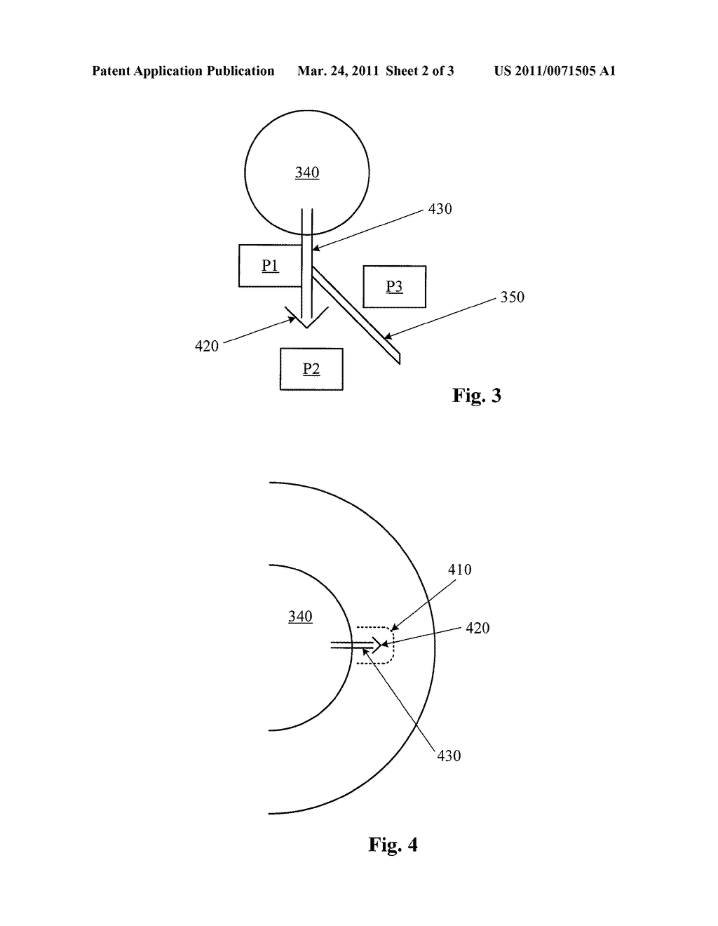 Intraocular Pressure Sensor with External Pressure Compensation - diagram, schematic, and image 03