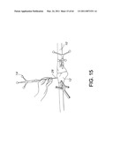 SYSTEMS USING IMAGING DATA TO FACILITATE SURGICAL PROCEDURES diagram and image