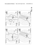 SYSTEMS USING IMAGING DATA TO FACILITATE SURGICAL PROCEDURES diagram and image