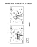 SYSTEMS USING IMAGING DATA TO FACILITATE SURGICAL PROCEDURES diagram and image