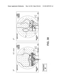 SYSTEMS USING IMAGING DATA TO FACILITATE SURGICAL PROCEDURES diagram and image