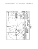 SYSTEMS USING IMAGING DATA TO FACILITATE SURGICAL PROCEDURES diagram and image