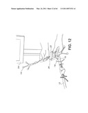 Systems Using Imaging Data to Facilitate Surgical Procedures diagram and image