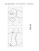 Systems Using Imaging Data to Facilitate Surgical Procedures diagram and image