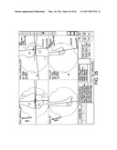 Systems Using Imaging Data to Facilitate Surgical Procedures diagram and image