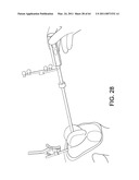 Systems Using Imaging Data to Facilitate Surgical Procedures diagram and image