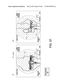 Systems Using Imaging Data to Facilitate Surgical Procedures diagram and image