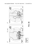 Systems Using Imaging Data to Facilitate Surgical Procedures diagram and image