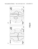 Systems Using Imaging Data to Facilitate Surgical Procedures diagram and image