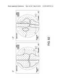 Systems Using Imaging Data to Facilitate Surgical Procedures diagram and image