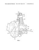 Patient-Specific Orthopedic Instruments diagram and image