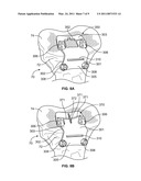 Patient-Specific Orthopedic Instruments diagram and image