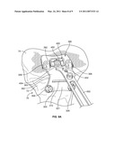 Patient-Specific Orthopedic Instruments diagram and image