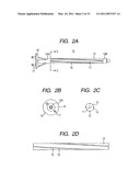 Intramedullary Rod for Assisting Total Knee Joint Replacing Operation and Method for Controle Operation Using the Rod diagram and image