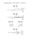 Intramedullary Rod for Assisting Total Knee Joint Replacing Operation and Method for Controle Operation Using the Rod diagram and image