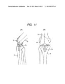 Intramedullary Rod for Assisting Total Knee Joint Replacing Operation and Method for Controle Operation Using the Rod diagram and image