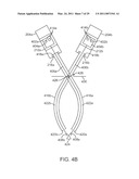 CURVED CANNULA diagram and image