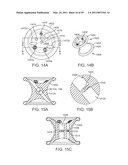 CURVED CANNULA diagram and image