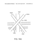 CURVED CANNULA diagram and image