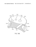 CURVED CANNULA diagram and image