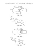 CURVED CANNULA diagram and image