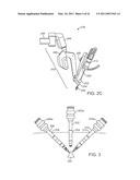 CURVED CANNULA SURGICAL SYSTEM CONTROL diagram and image