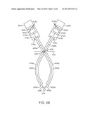 CURVED CANNULA SURGICAL SYSTEM CONTROL diagram and image