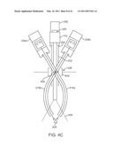 CURVED CANNULA SURGICAL SYSTEM CONTROL diagram and image