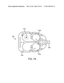 CURVED CANNULA SURGICAL SYSTEM CONTROL diagram and image