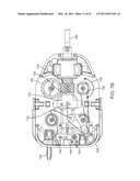 CURVED CANNULA SURGICAL SYSTEM CONTROL diagram and image