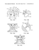 CURVED CANNULA SURGICAL SYSTEM CONTROL diagram and image