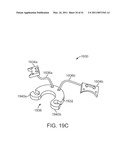 CURVED CANNULA SURGICAL SYSTEM CONTROL diagram and image