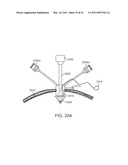 CURVED CANNULA SURGICAL SYSTEM CONTROL diagram and image