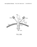 CURVED CANNULA SURGICAL SYSTEM CONTROL diagram and image