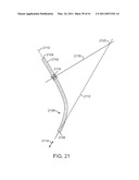 CURVED CANNULA SURGICAL SYSTEM CONTROL diagram and image