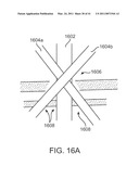 CURVED CANNULA INSTRUMENT diagram and image