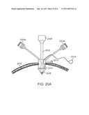 CURVED CANNULA INSTRUMENT diagram and image