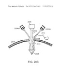 CURVED CANNULA INSTRUMENT diagram and image