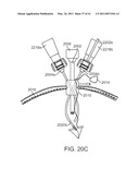 CURVED CANNULA INSTRUMENT diagram and image