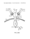 CURVED CANNULA INSTRUMENT diagram and image